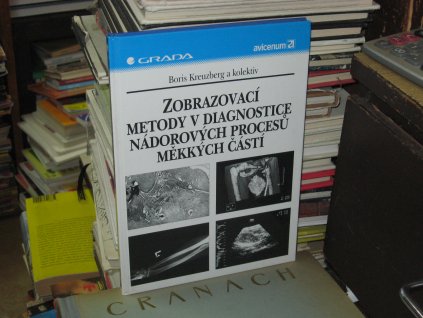 Zobrazovací metody v diagnostice nádorových procesů měkkých tkání