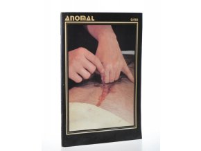 Anomal : 0/90