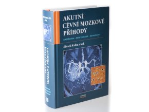 Akutní cévní mozkové příhody : diagnostika, patofyziologie, management