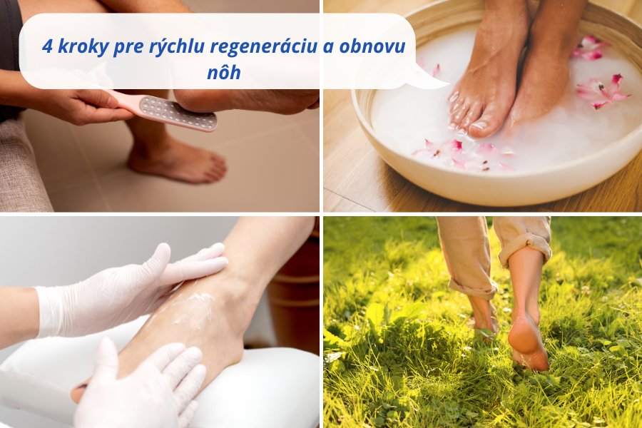 Jar prichádza! Ako rýchlo dostať nohy späť do formy po zime?