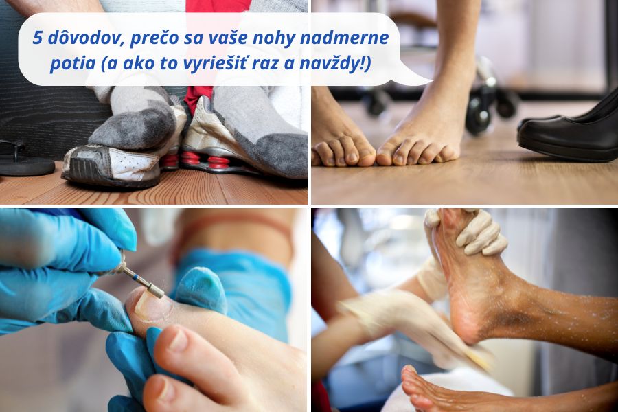 5 dôvodov, prečo sa vaše nohy nadmerne potia (a jednoduché riešenia, ktoré fungujú!)