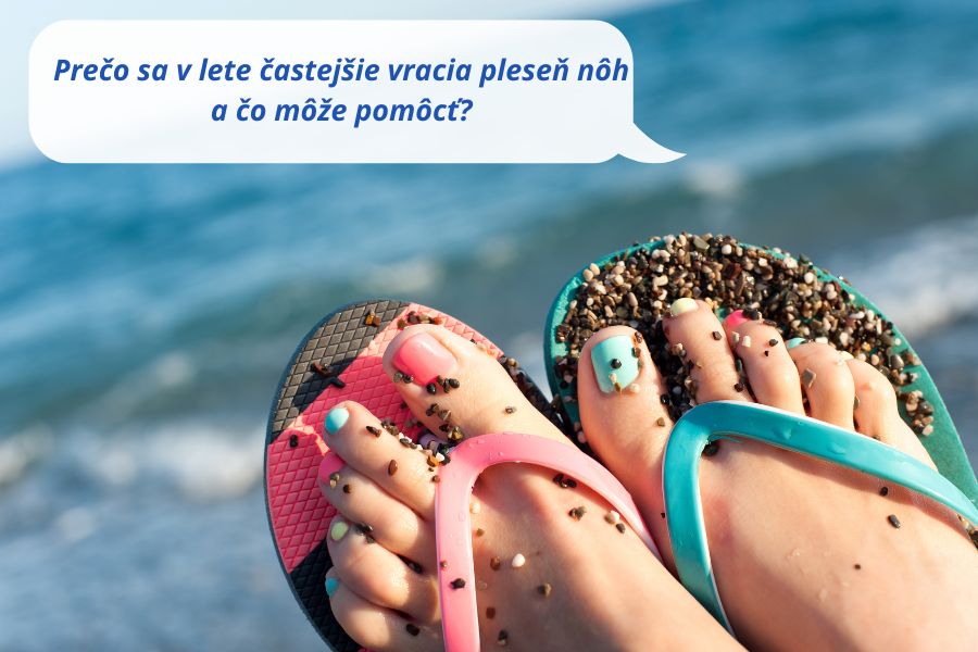 Prečo sa v lete častejšie vracia pleseň nôh a čo môže pomôcť