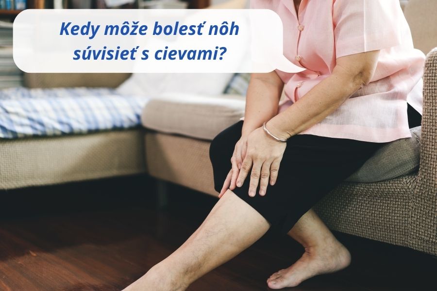 Kedy môže bolesť nôh súvisieť s cievami?