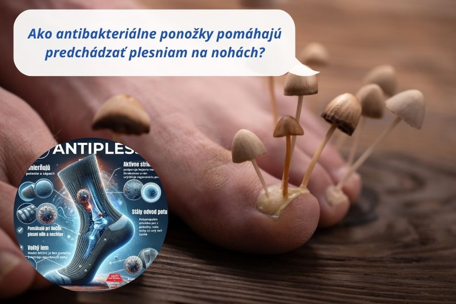 Ako antibakteriálne ponožky pomáhajú predchádzať plesniam na nohách?