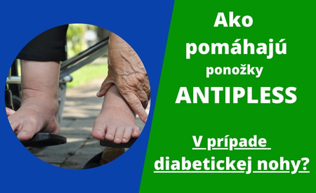 Ako pomáhajú ponožky ANTIPLESS v prípade opuchnutej a diabetickej nohe?