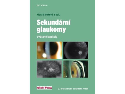 Sekundární glaukomy - Vybrané kapitoly (Stav Nová)