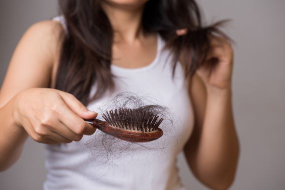Vše o alopecii: Kdy se objevuje a jaké jsou možnosti léčby