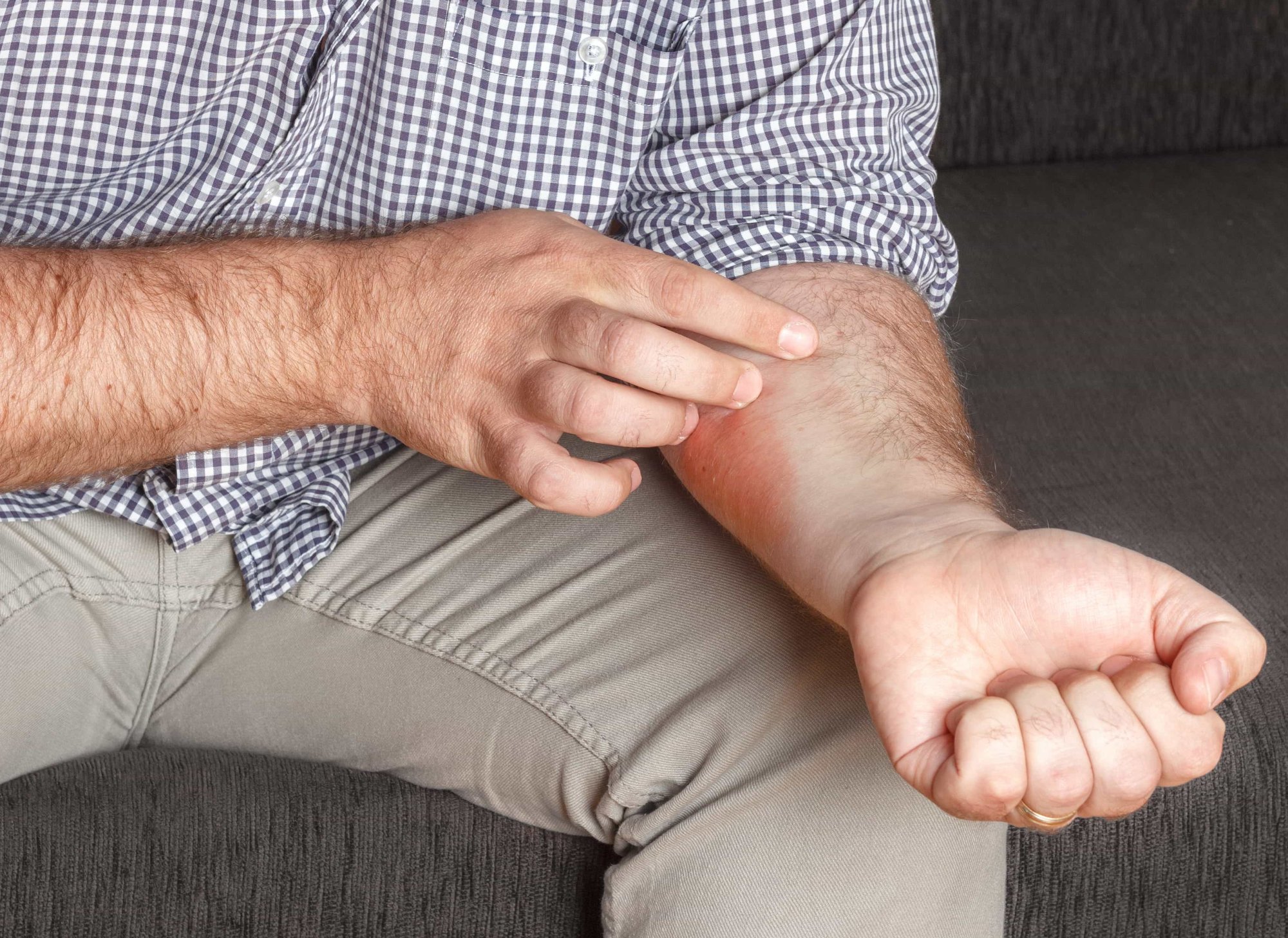 Život so psoriázou nemusí byť boj: Overené spôsoby, ako upokojiť zápal a vrátiť si sebavedomie