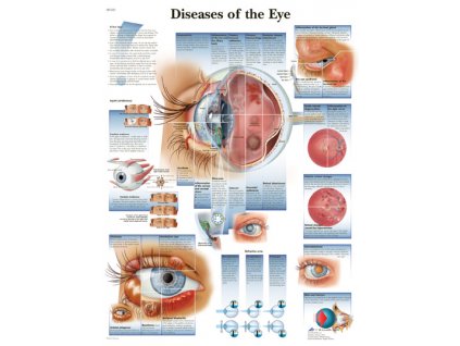 Výuková anatomie - oko