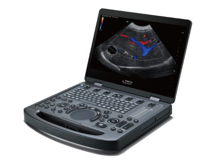 Vetus E5 003