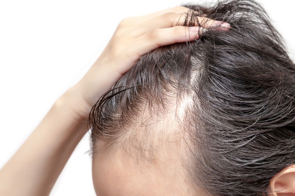 Příčiny vypadávání vlasů u mužů a žen + účinná řešení pro růst vlasů