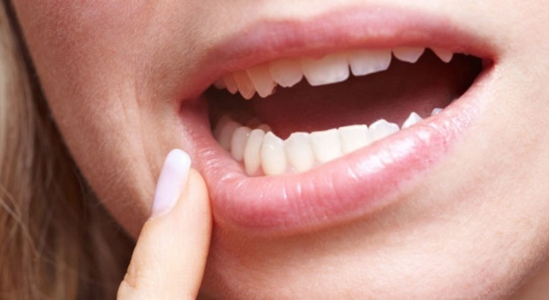 Zápaly v ústnej dutine môžu byť veľmi bolestivé