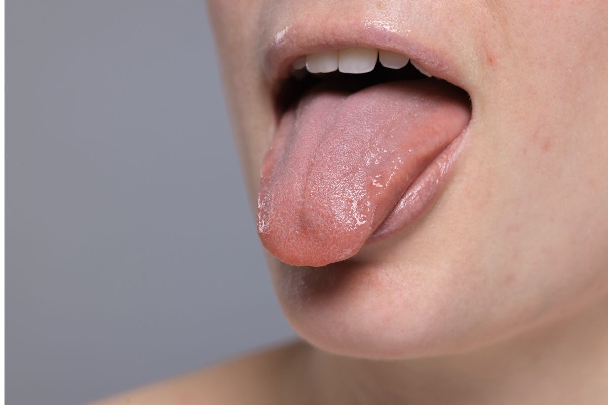 Sucho v ústach po zime: príčiny, príznaky a účinné riešenie xerostómie