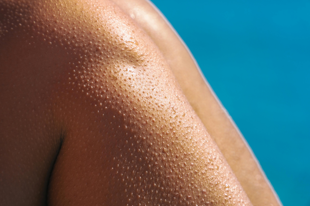 Koža ako barometer zdravia