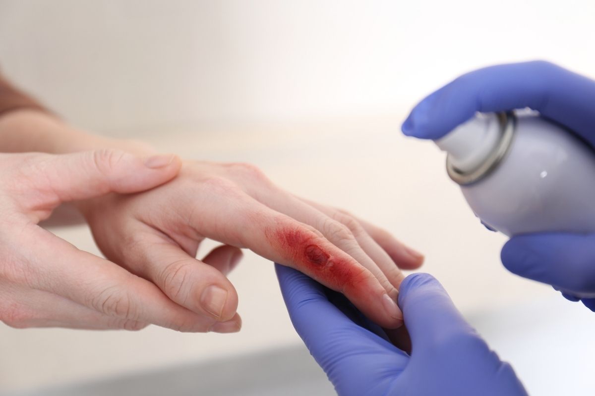 Prvá pomoc pri úrazoch: Ako správne ošetriť rany a urýchliť hojenie?