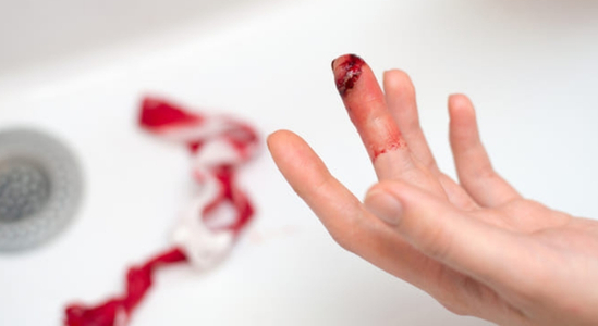 Ilustračná fotografia