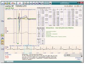 Modul Interpetace a rozměření EKG SEIVA Praktik