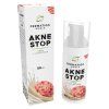 akneStop