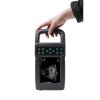 ultrazvukovy skener kx5600l s digitalni abdominalni sondou