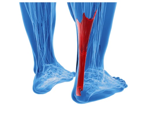 Jak zima a chlad ovlivňuje achillovu šlachu?