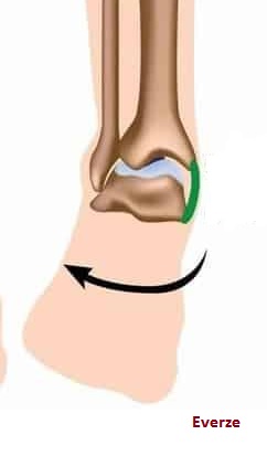 Co to je everzní úhel a jak může ovlivnit náš běh