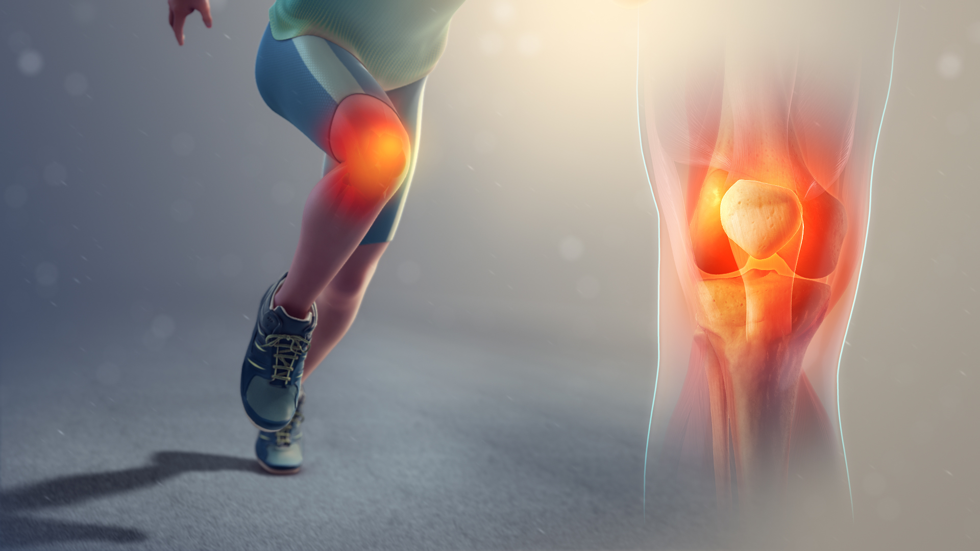 Femoropatelární syndrom - "běžecké koleno" 