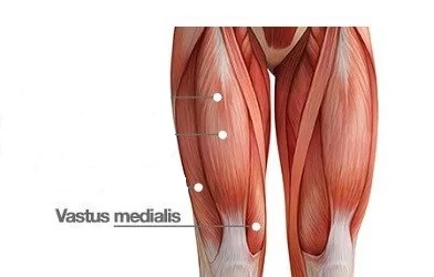 Vastus Medialis - důležitý sval pro běžce