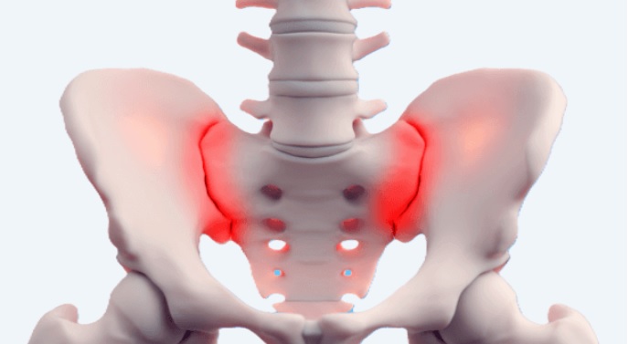 sakroiliakální_kloub