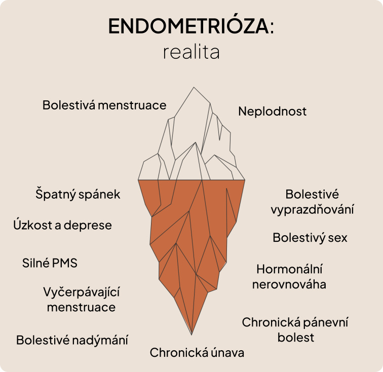 Endometrióza – realita