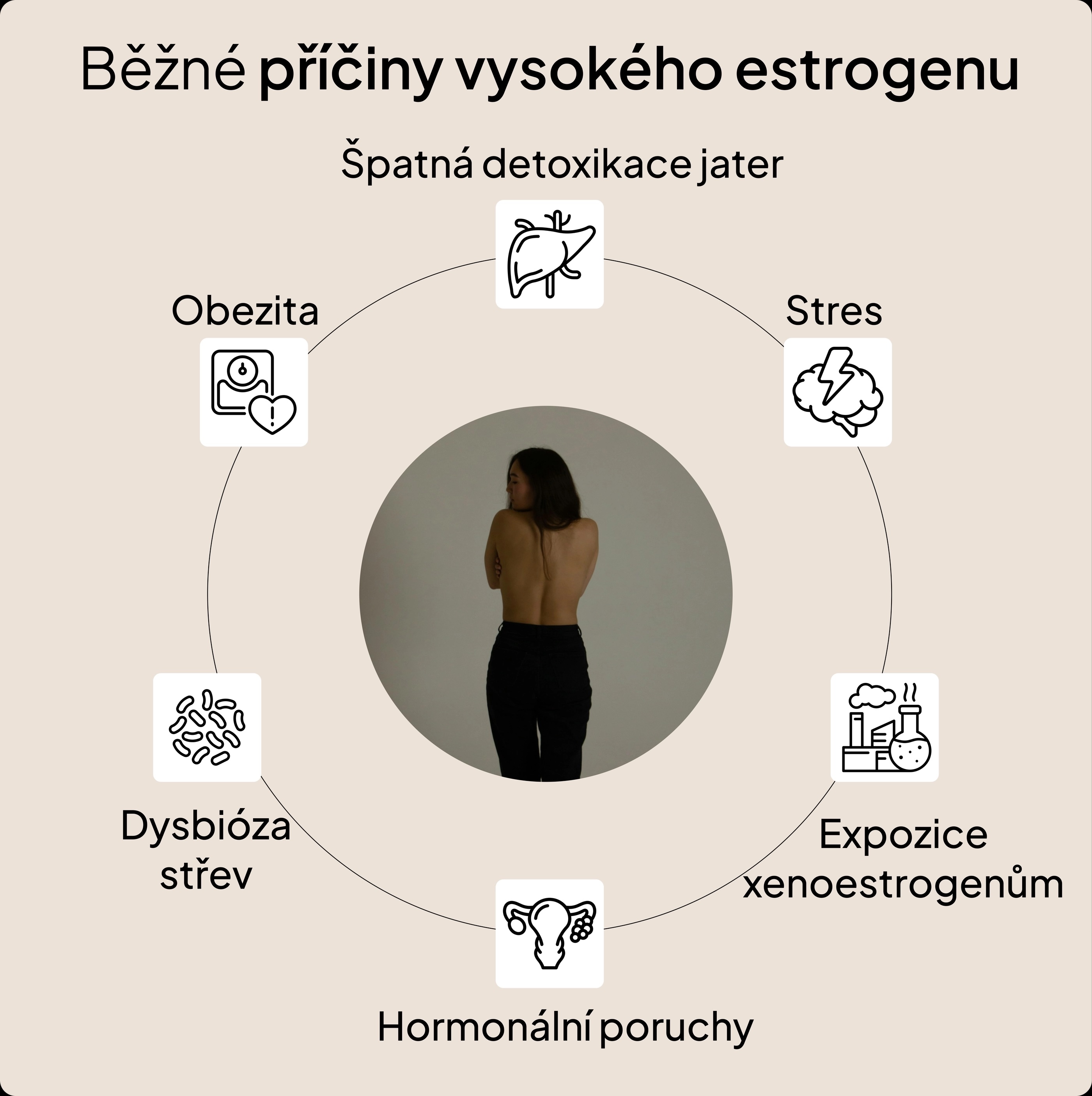 priciny_vysokeho_estrogenu