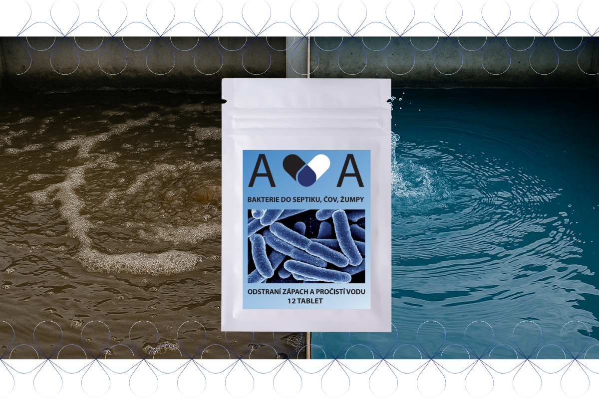 5 nejčastějších problémů s ČOV