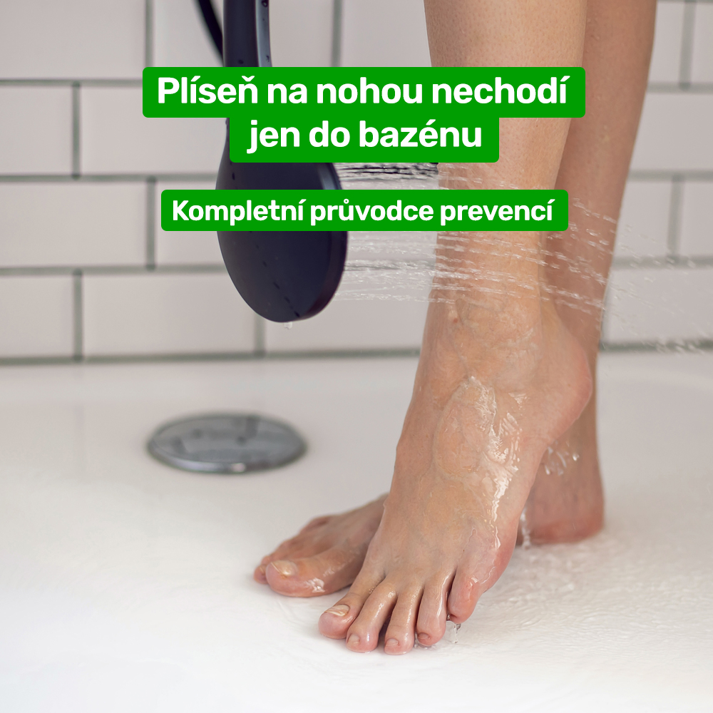 Plíseň na nohou nechodí jen do bazénu: kompletní průvodce prevencí