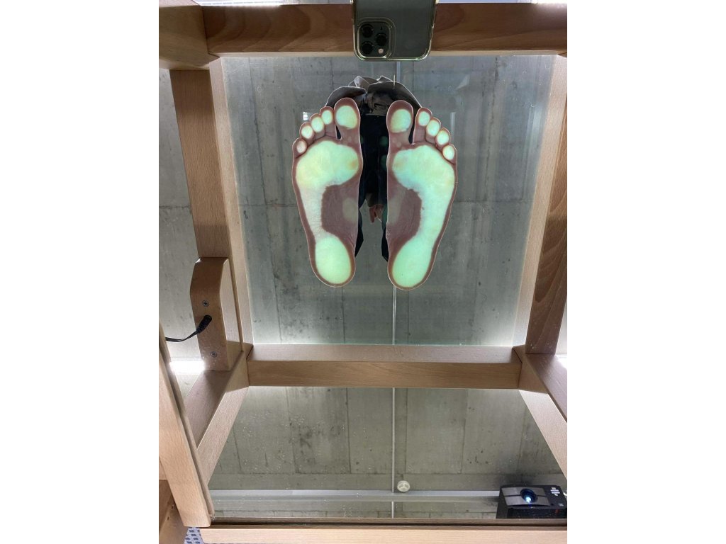 Diagnostika pomocí PODOSKOPU a PLANTOGRAFU