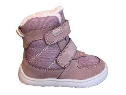 Protetika LORA Old Pink