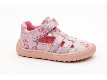 Protetika OVE Butterfly