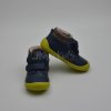 PROTETIKA HARPER NAVY