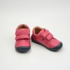 PROTETIKA LARS PINK