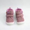 PROTETIKA NIRA OLD PINK