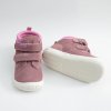 PROTETIKA NIRA OLD PINK