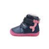 Anatomic barefoot bačkory auta B002B