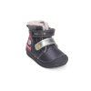 Anatomic barefoot bačkory auta B002B