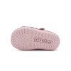 S070 62659B Raspberry 05