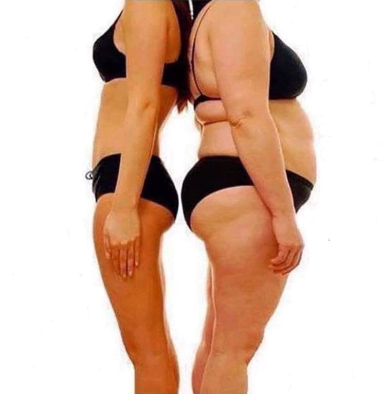 Jak to vypadá po operaci (rok 1 a více)