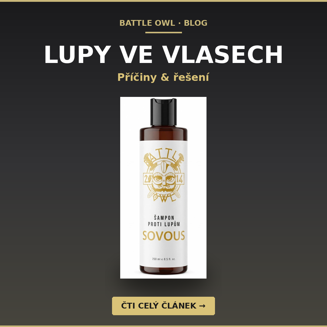 Lupy ve vlasech: co je způsobuje, jak vznikají a jak se jich definitivně zbavit