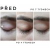 Výsledky růstu řas po hairPLUS – před a po 4 a 7 týdnech
