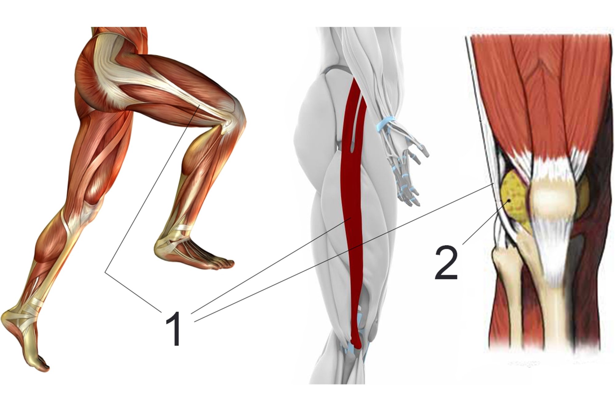 Bolest kolene na vnější straně při běhu nebo po něm