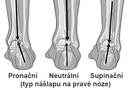 Jaký typ nášlapu máte? Co je pronace?