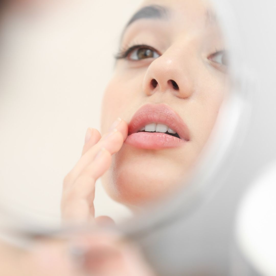 JAK SE STARAT O PLEŤ VYLÉČENOU Z AKNÉ