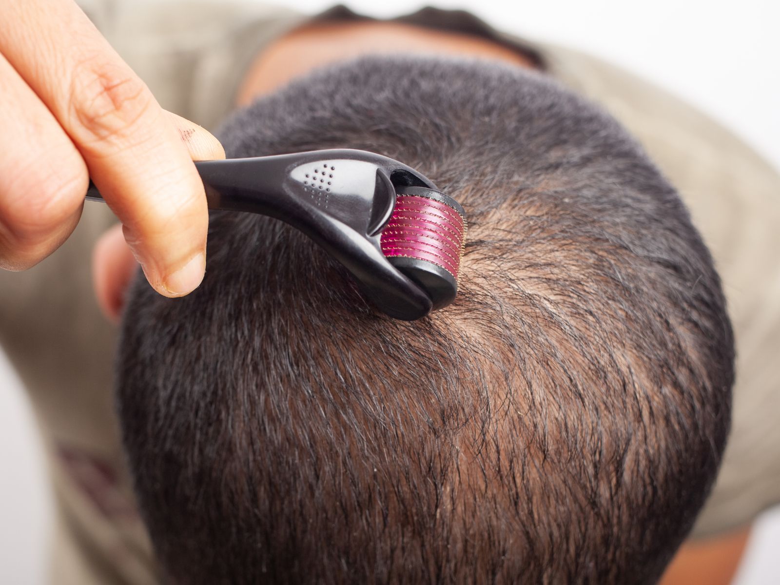 Mikrojehličkování