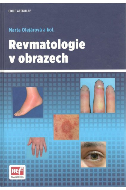 Revmatologie v obrazech